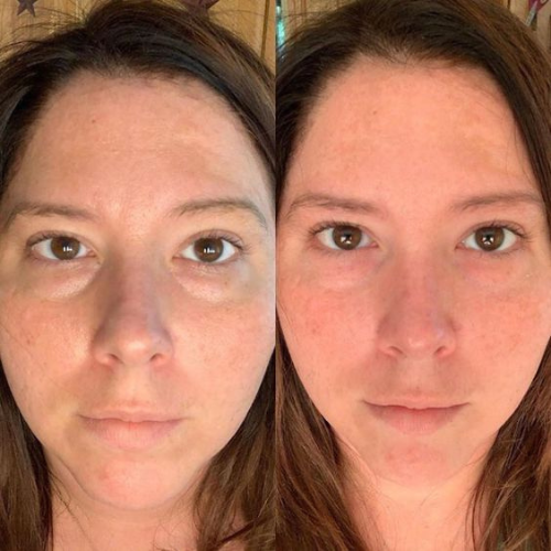 Baguette anti-âge élite