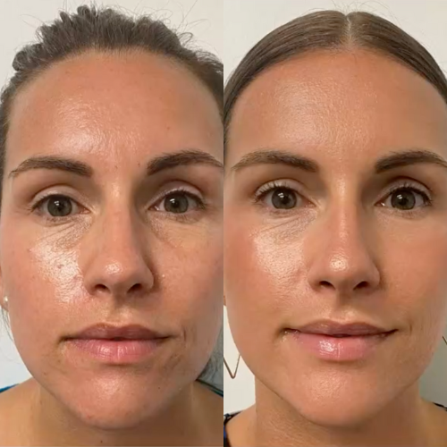 Baguette anti-âge élite